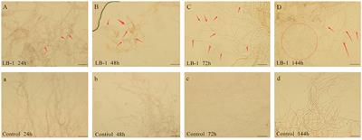 Antifungal metabolites of biocontrol stain LB-1 and their inhibition mechanism against Botrytis cinerea